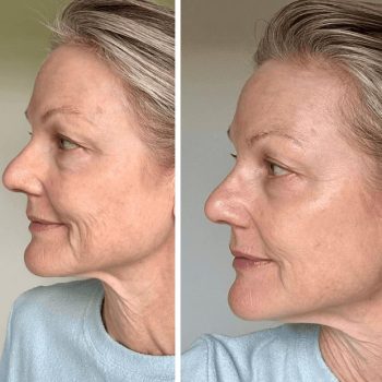 Trudermal Advanced ++ LED Face Mask